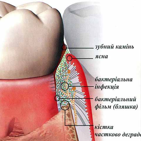 Строение пародонта