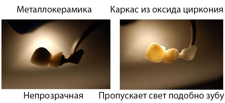 Безметалловая керамика